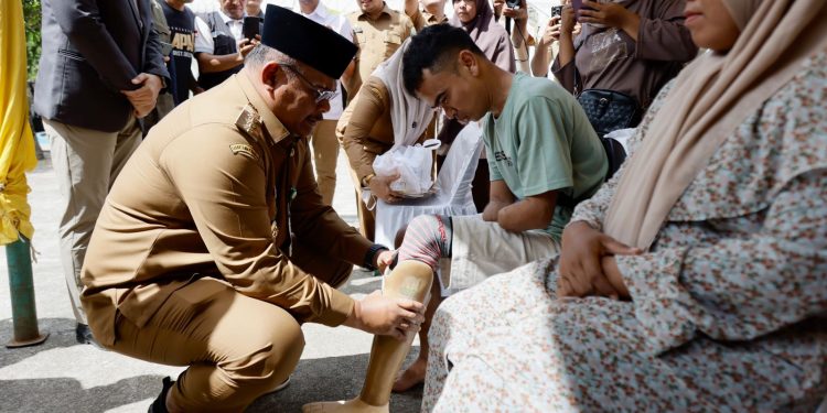 Pj Gubernur Safrizal Pasangkan Kaki Palsu untuk Penyandang Disabilitas